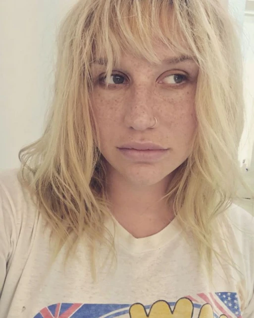 Kesha